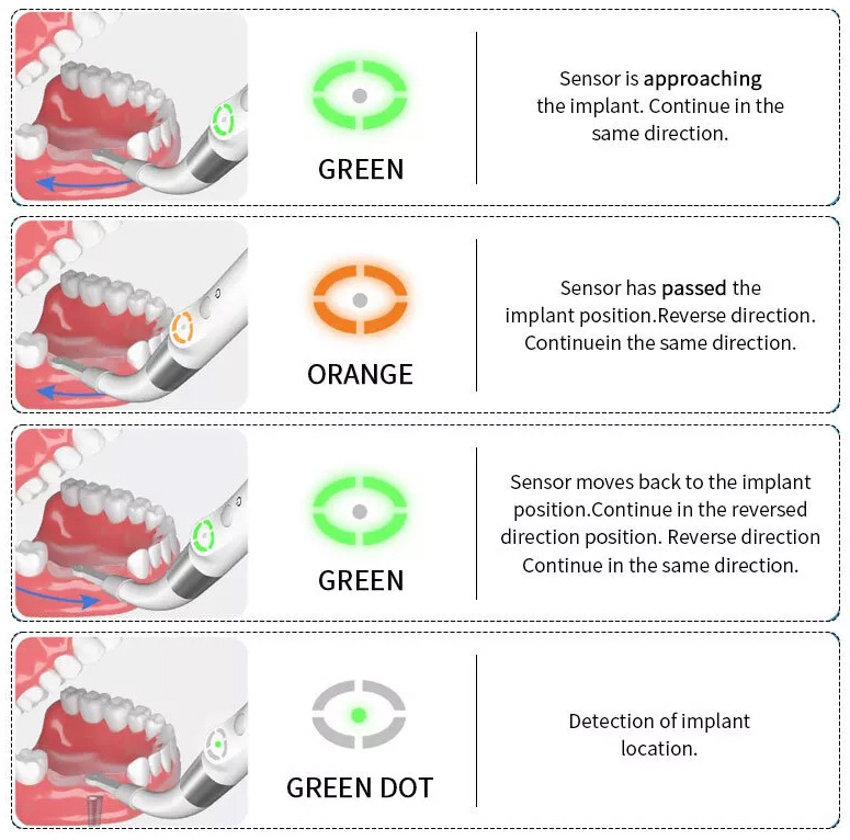 YAHAPE iD1 Dental Implant Locator Implant Smart Finder Detector